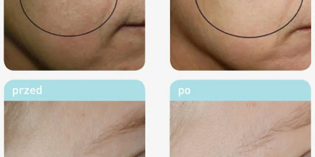 Pracownia Urody Gdańsk - Zdjęcie 8